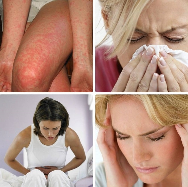 Аллергия: виды, симптомы и признаки, профилактика - фото4