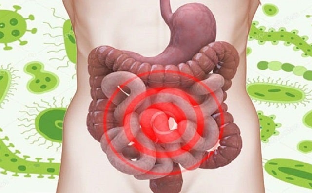 Диарея: что это такое, причины, профилактика - фото2 Диарея: что это такое, причины, профилактика - фото2