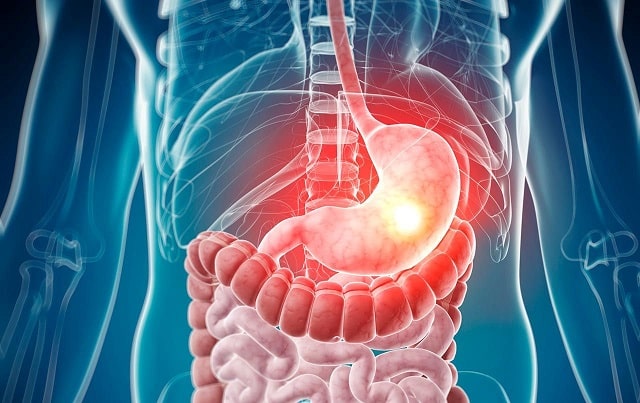 Расстройство желудка: что это такое, виды, симптомы, профилактика - фото2