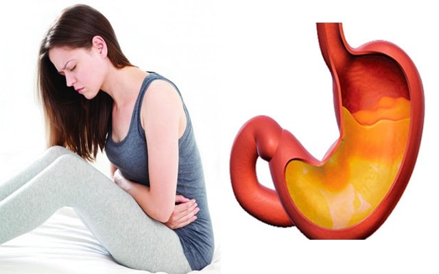 Расстройство желудка: что это такое, виды, симптомы, профилактика - фото4