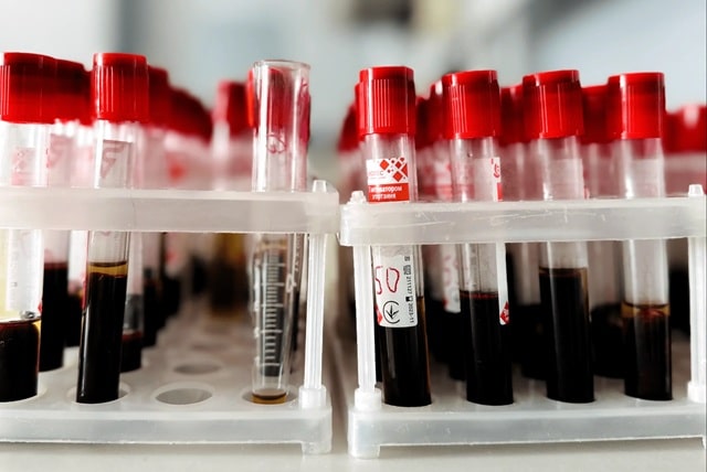 Онкомаркери у діагностиці раку грудей