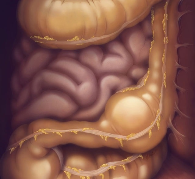 Запор: что это такое, причины, симптомы, профилактика - фото4 Запор: что это такое, причины, симптомы, профилактика - фото4