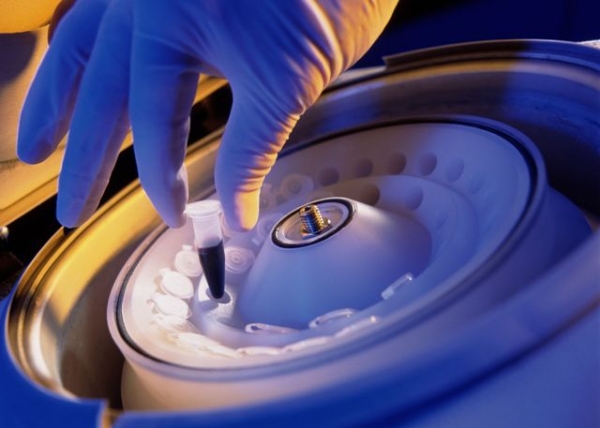 Ультрацентрифуга: что это такое и где применяется