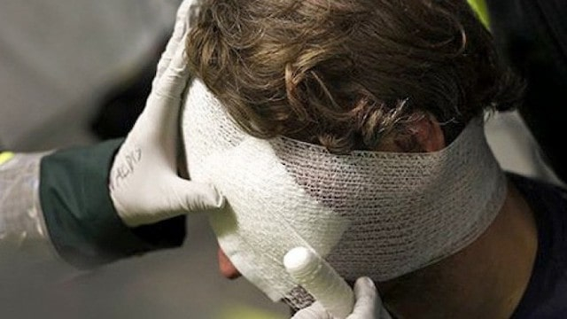 Приезжие строители в Мариуполе проломили голову местному жителю