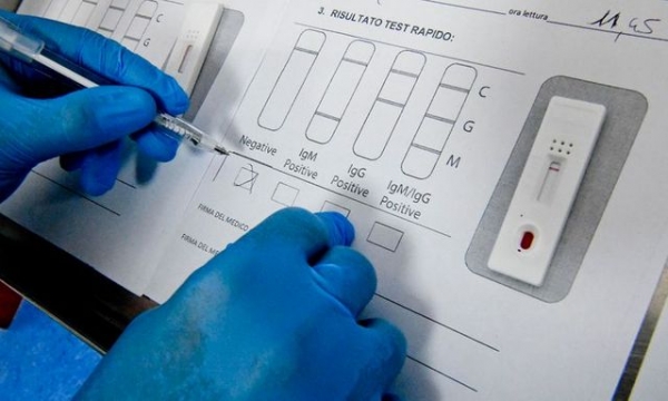 В Донецкой области увеличили количество тестирований на COVID-19