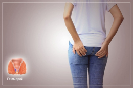 Что такое геморрой, и чем он опасен: особенности, симптомы, профилактика