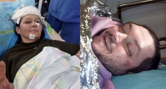 Подробности обстрела волонтеров вблизи Зайцево