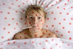 В Донецке зафиксировали корь: источник – вернувшиеся из Вьетнама