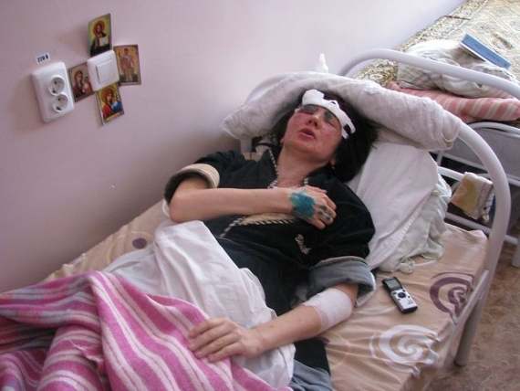 Взрыв маршрутки в Донецке: 2 погибших, 6 пострадавших (подробности)