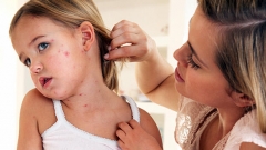 В «ДНР» опасный недуг продолжает атаковать граждан