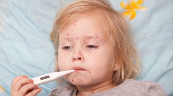 На Донетчине зафиксировано более 120 случаев опасного заболевания