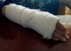 Военнослужащая выпала из маршрутки и сломала руку - реакция водителя поражает