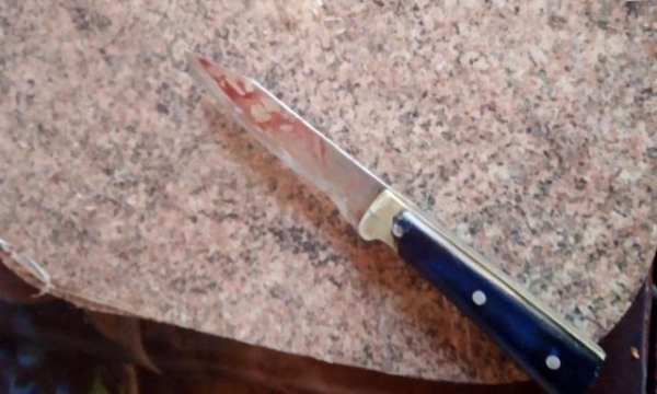 47-летний житель Мариуполя тяжело ранил свою бывшую сожительницу